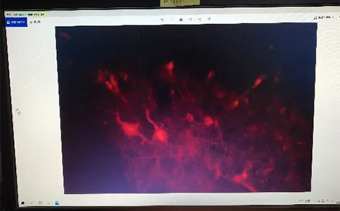 做光纤记录实验采不到荧光信号？注意事项在这里