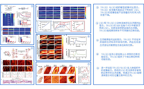 微循环血流仪变迁史，提前剧透新一代激光散斑血流成像为何更强大
