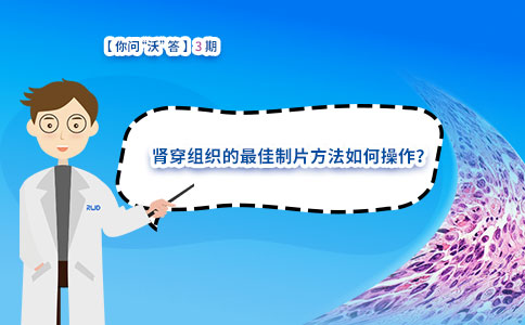 肾穿组织的最佳制片方法如何操作？