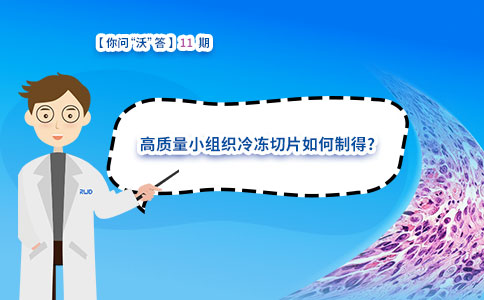 高质量小组织冷冻切片如何制得?