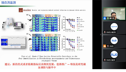 大成学堂 | 卒中研究系列讲座3期精彩全放送！让你一次就学透！