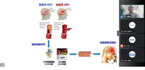 大成学堂 | 卒中研究系列讲座3期精彩全放送！让你一次就学透！