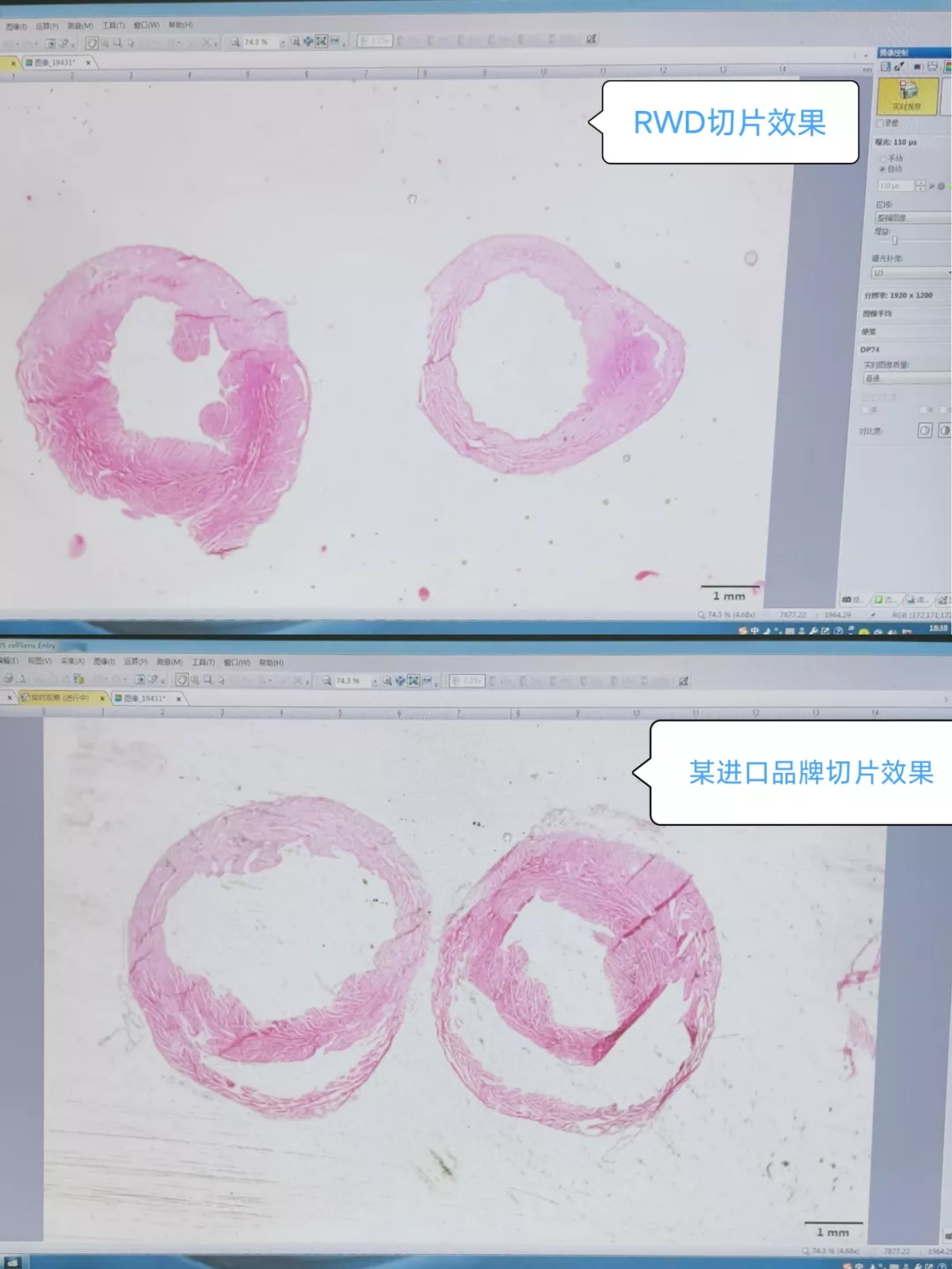 切片对比