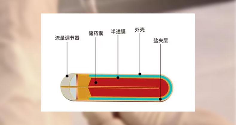 缓释泵超全使用操作小指南！