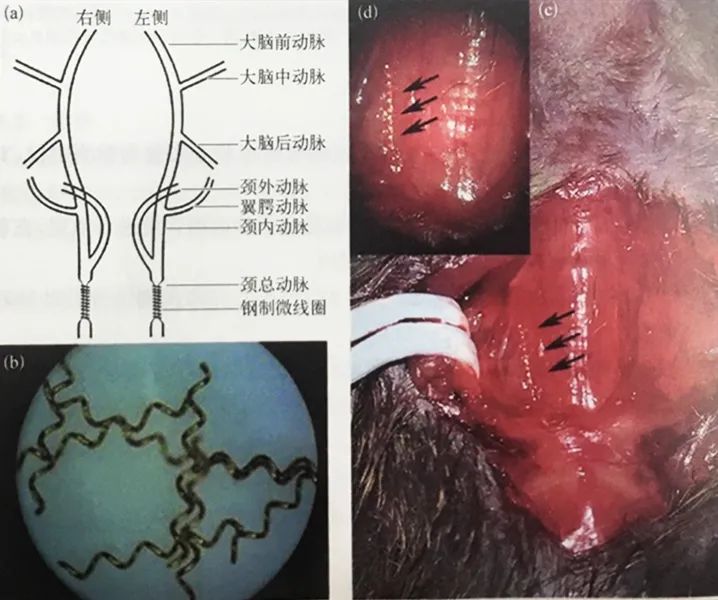 小鼠二血管狭窄模型操作步骤