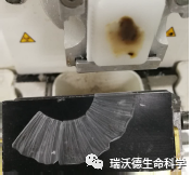 蜡带侧弯