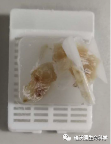 组织发生裂隙破碎或崩脱