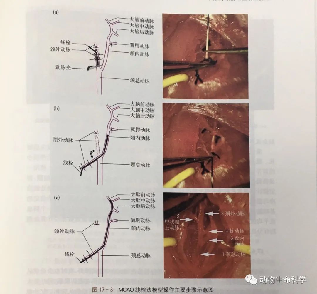 线栓法模型操作主要步骤