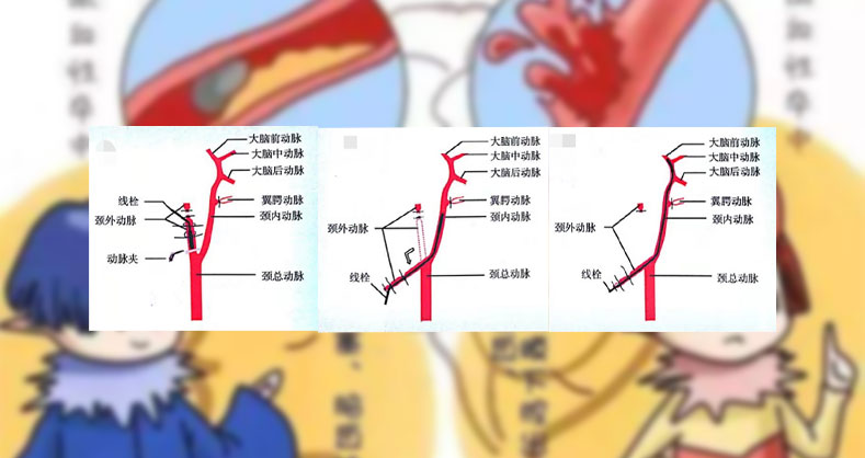 MCAO模型要点解析