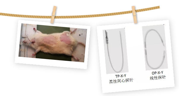 皮肤透析