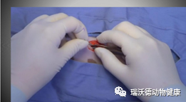 沿腹中线切开腹壁