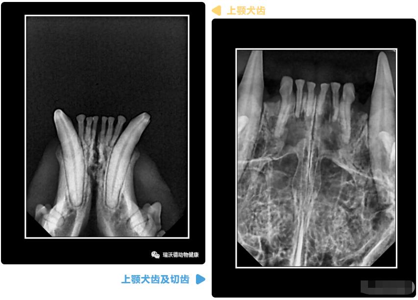 牙齿实拍