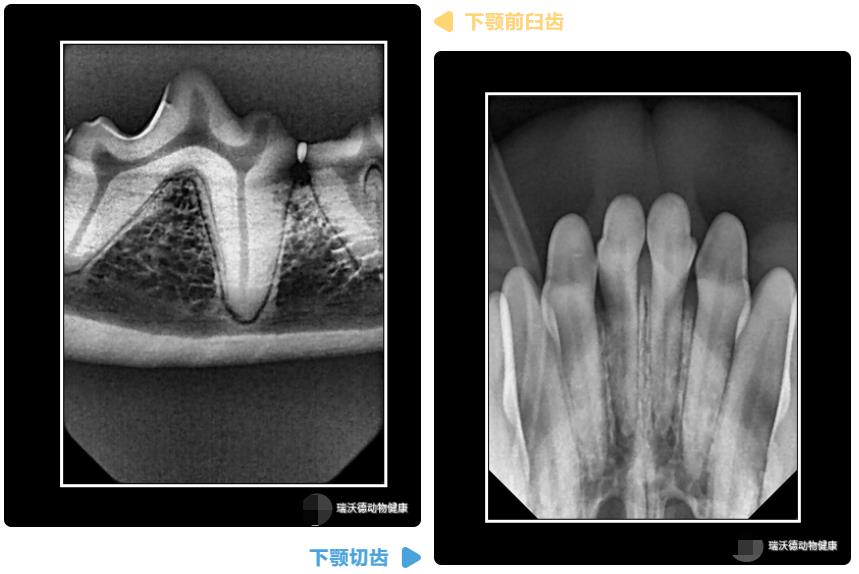 牙齿DR