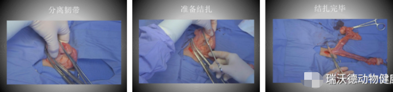 子宫结扎1
