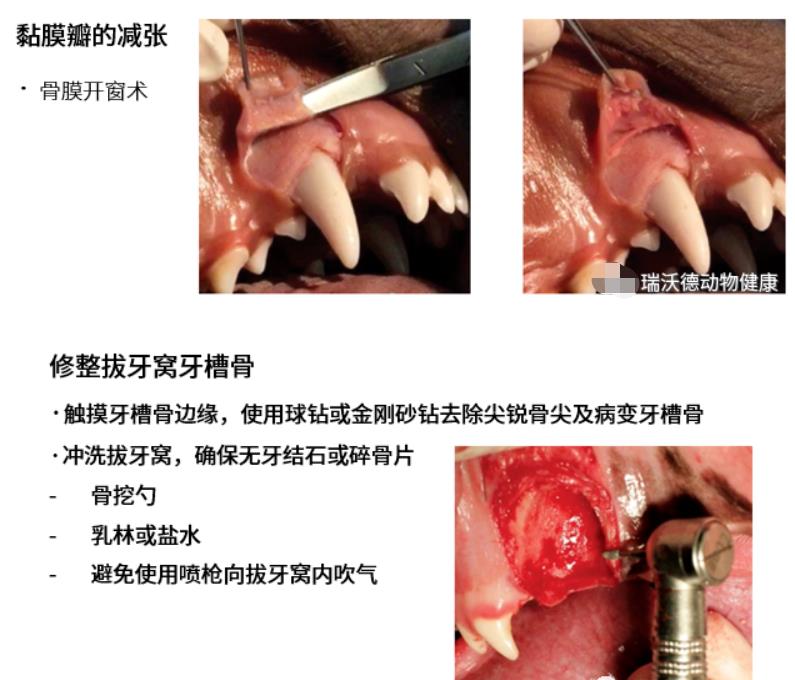 骨膜开窗