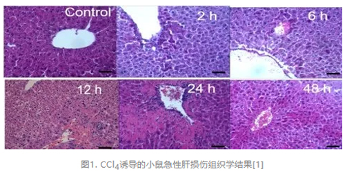 ob体育官网登录界面
病理切片机在四氯化碳诱导小鼠肝损伤模型中的应用
