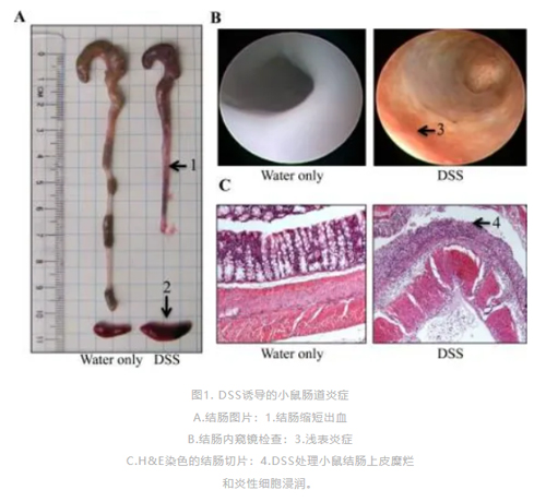 ob体育官网登录界面
病理切片机在炎症性肠病（IBD）模型中的应用