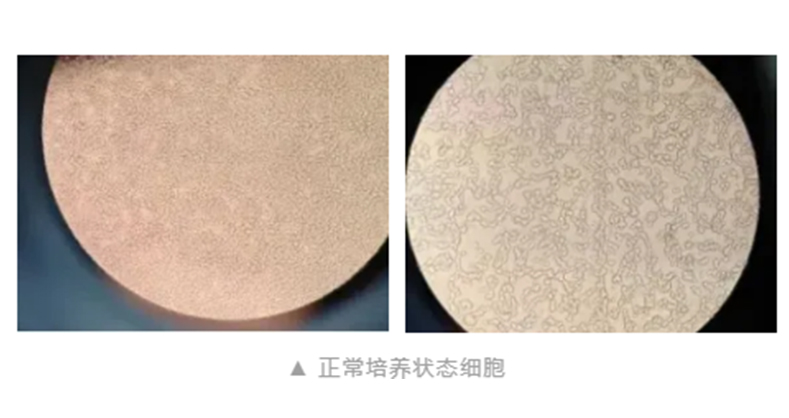 小鼠单核巨噬细胞RAW264.7培养注意事项